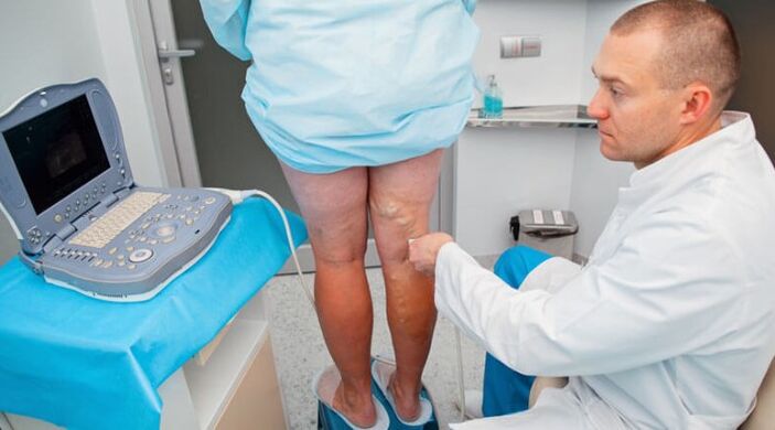 Diagnosticul de varice